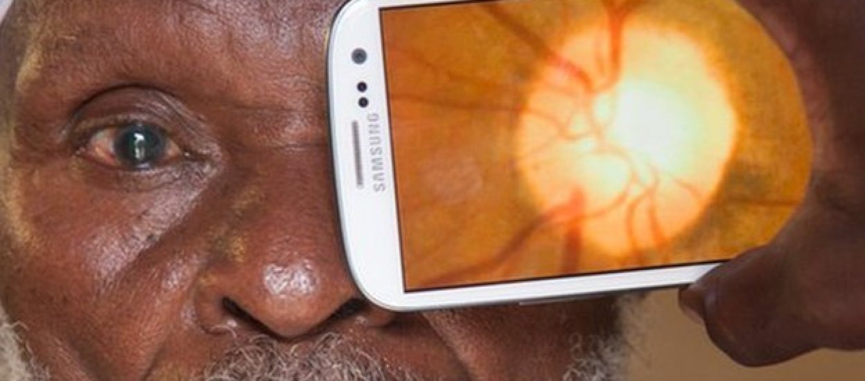Peek Retina - smartfon znowu wykorzystany w medycynie