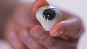 Oczy z drukarki 3D - dla wielu pacjentów to jedyna nadzieja na normalność